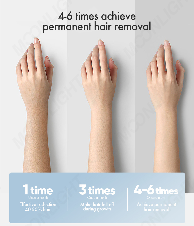 OEM/ODM Best Medical Laser Beauty Salon Use 808nm Laser Hair Removal 4 Wave for Diode Laser Hair Removal Machine Powerful Ai Function Beauty Salon Equipment