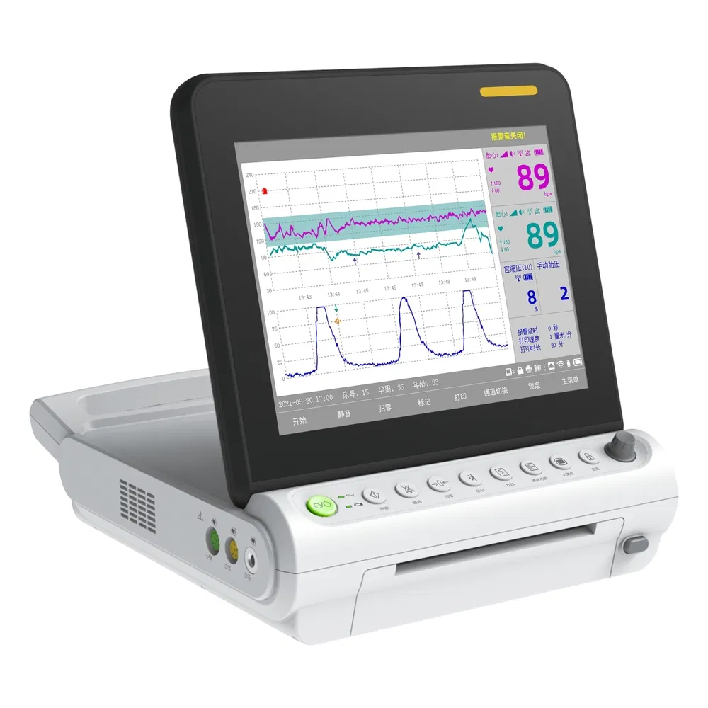 Etco2 Monitoring Medical Supply Patient Monitor Equipment for Respiratory Care