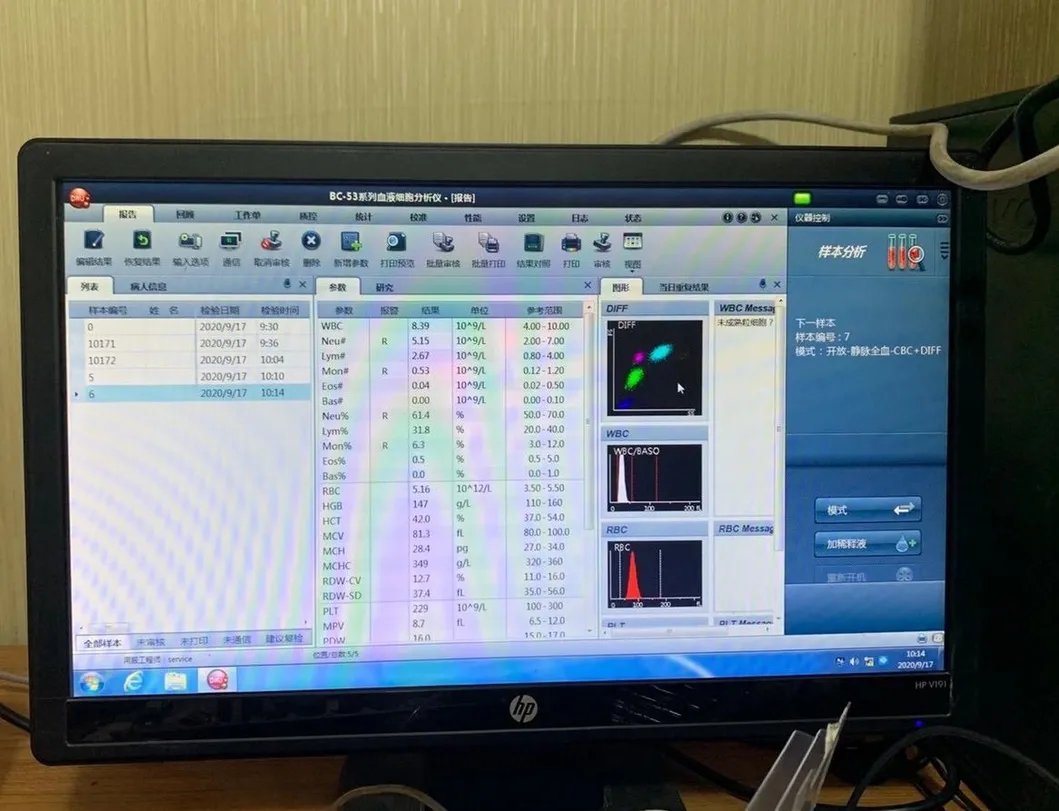 Hematology Analyzer 4