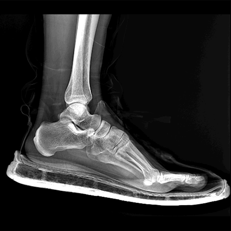 Versatile Diagnostic X Ray Machines Medical Diagnosis Equipment for Professionals