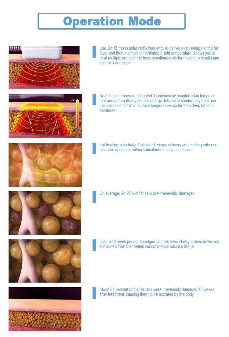 RF Treatment Handles