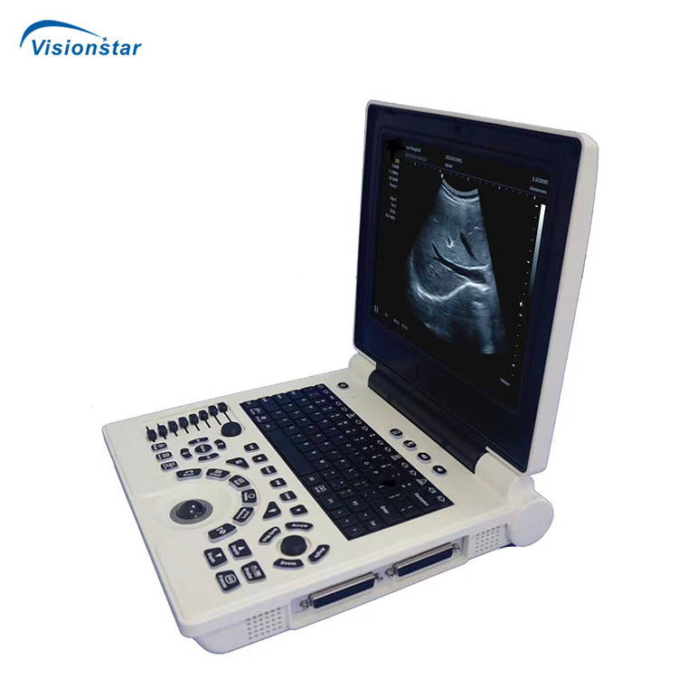 Medical Diagnosis Equipment Portable Professional Ultrasound Diagnostic Equipment with Ob Gyn