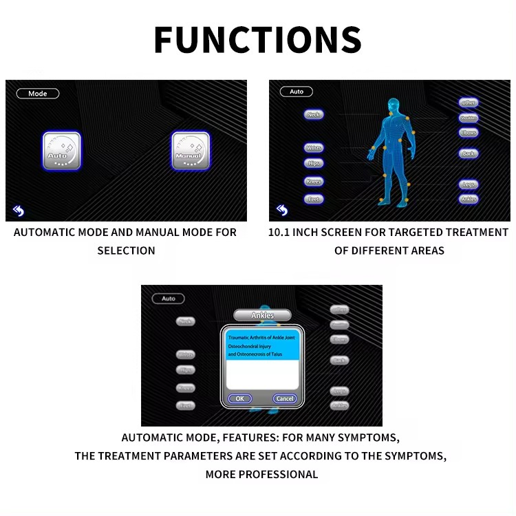 Source Supplier Wholesale Price Eswt Pneumatic Shockwave Therapy Device for Rehabilitation