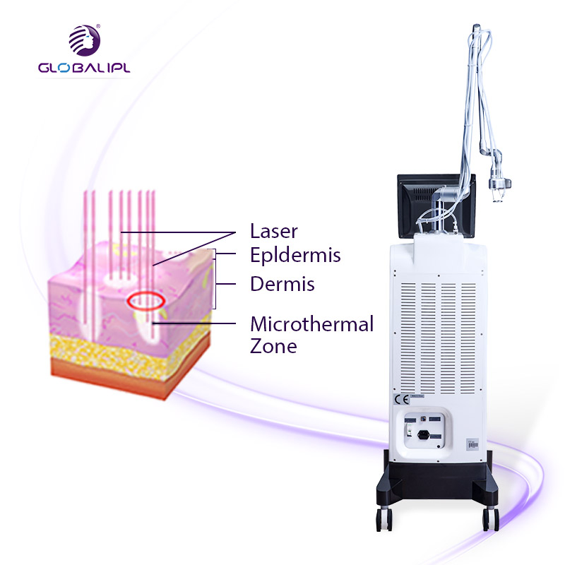RF Fractional CO2 Laser Medical Use Vaginal 10600nm Tightening Skin Resurface Beauty Salon Equipment