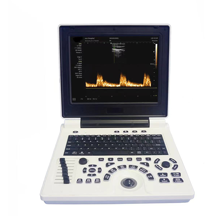 Medical Diagnosis Equipment Portable Professional Ultrasound Diagnostic Equipment with Ob Gyn