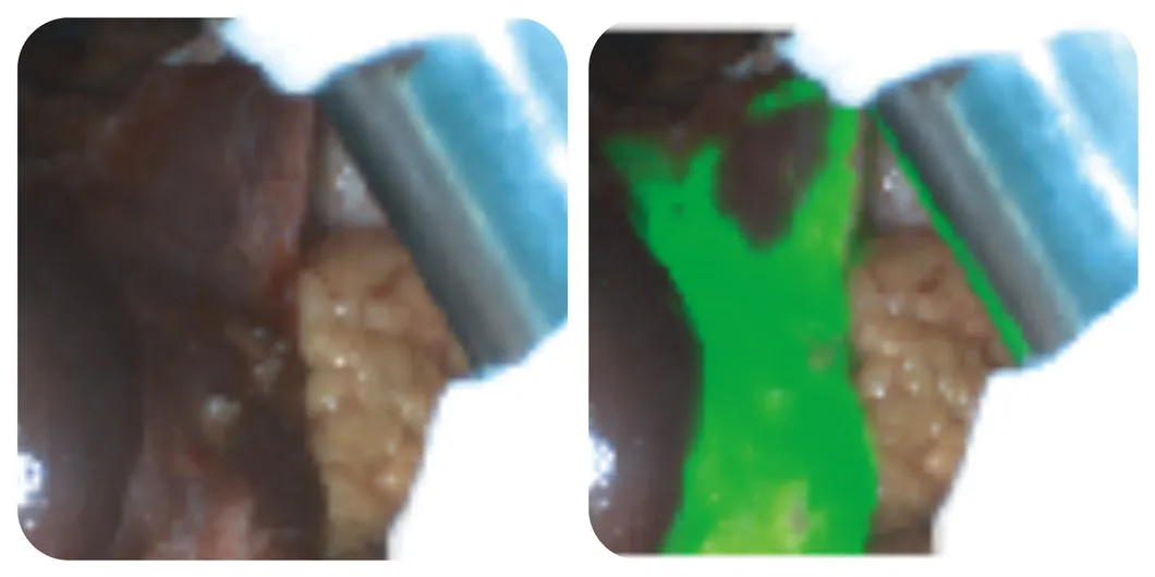 Biliary tract staining