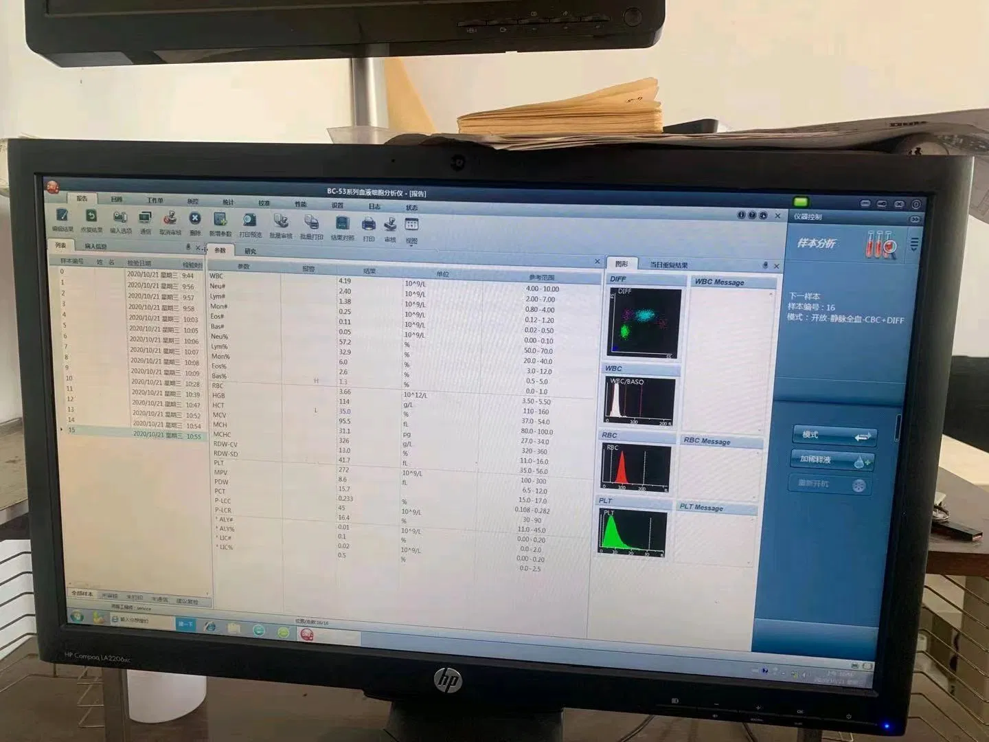 Hematology Analyzer Laboratory Instrument Clinical Hematology Equipment