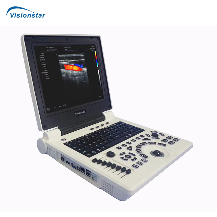 Medical Diagnosis Equipment Portable Professional Ultrasound Diagnostic Equipment with Ob Gyn