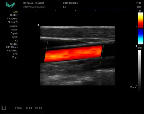 Ultrasound Machine Feature 1