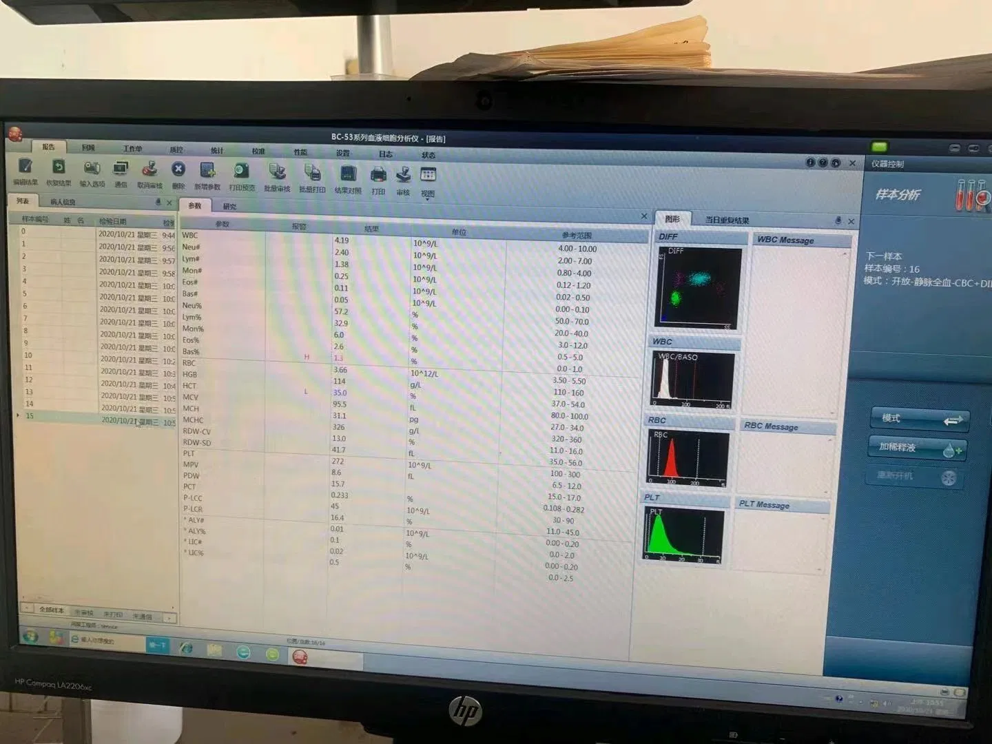 Hematology Analyzer Laboratory Instrument Clinical Hematology Equipment