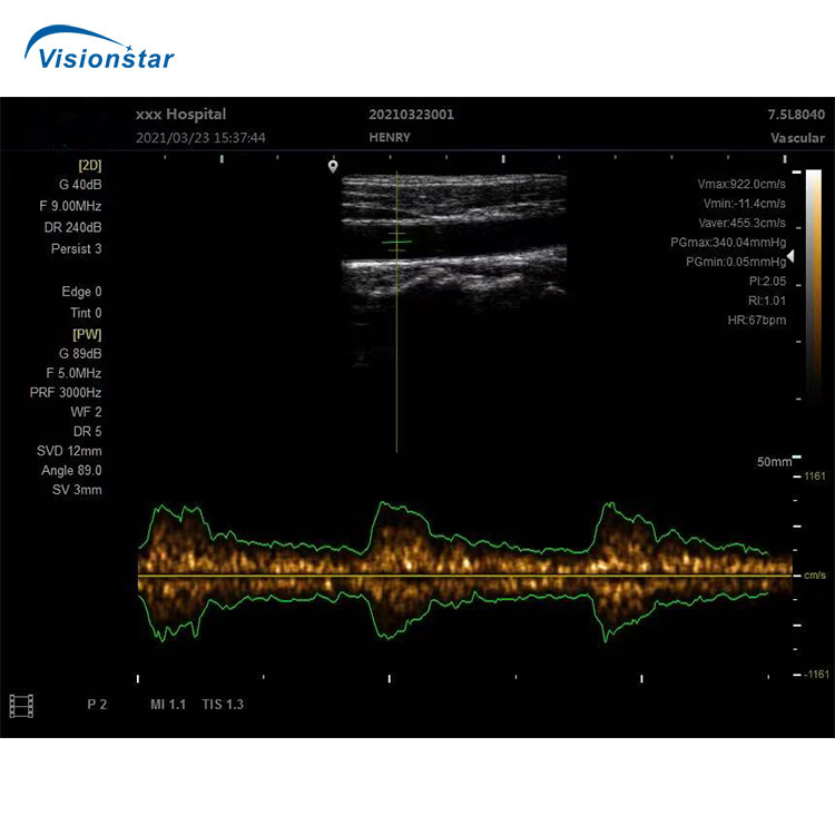 Medical Diagnosis Equipment Portable Professional Ultrasound Diagnostic Equipment with Ob Gyn