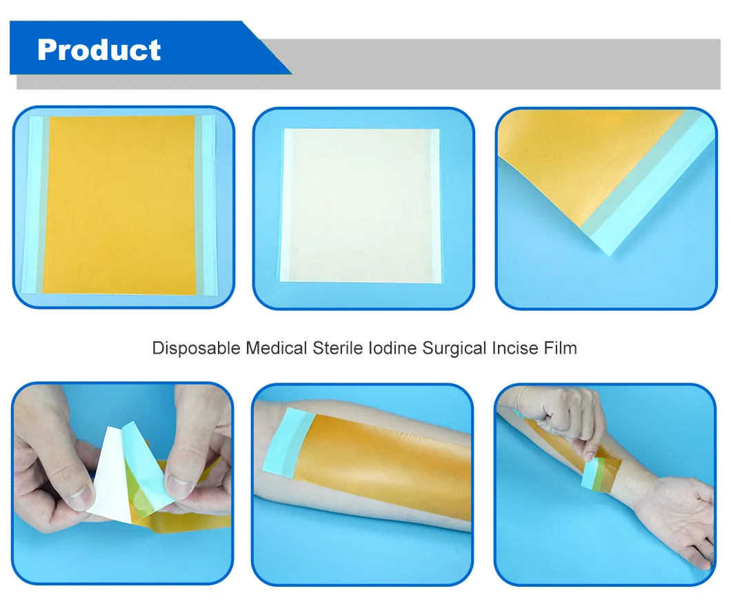 Antimicrobial Iodine Surgical Incise Drape 2