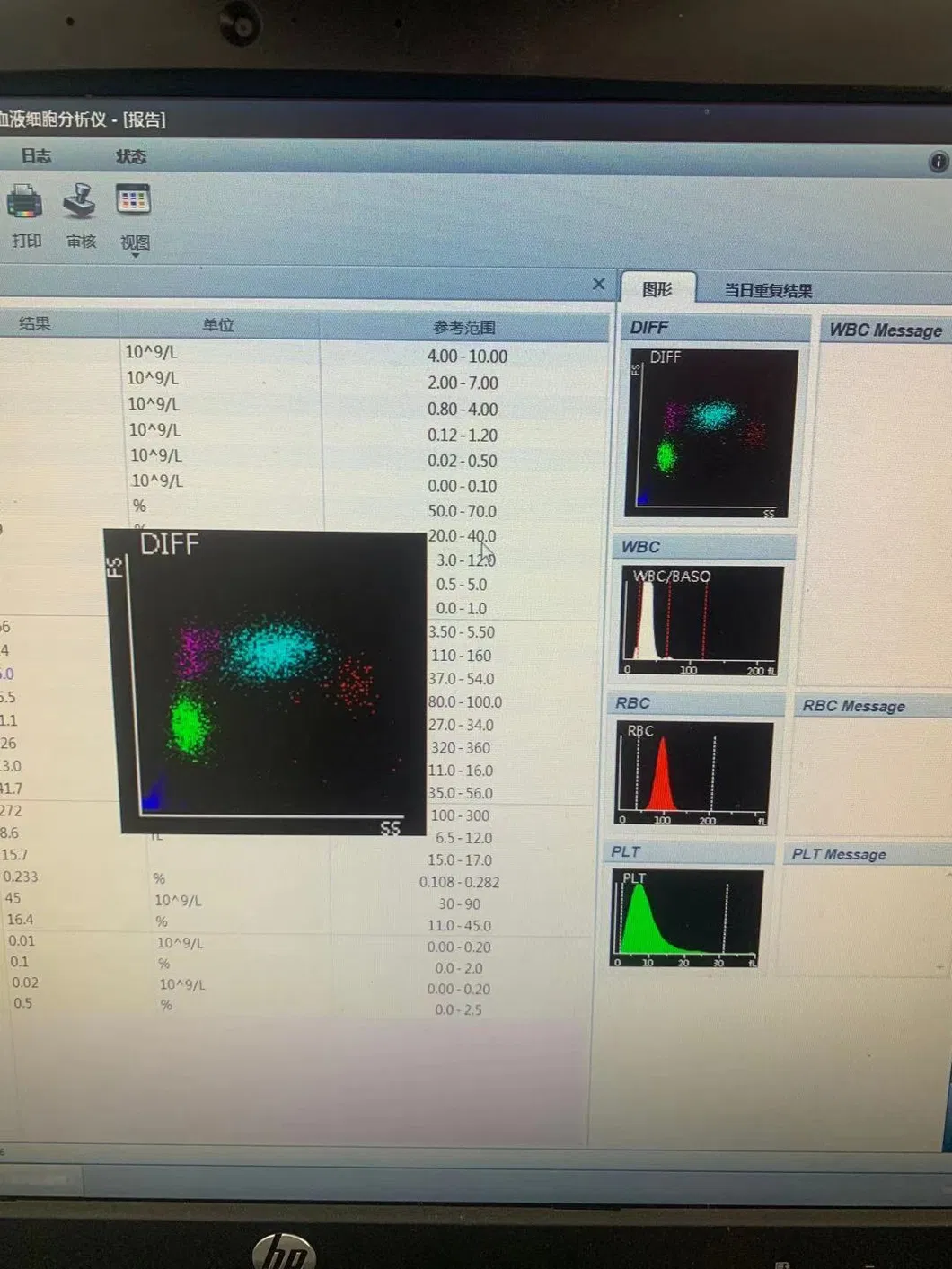 Hematology Analyzer 5