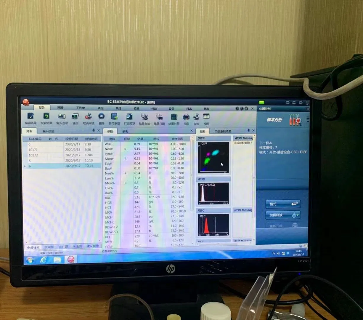 Hematology Analyzer Laboratory Instrument Clinical Hematology Equipment