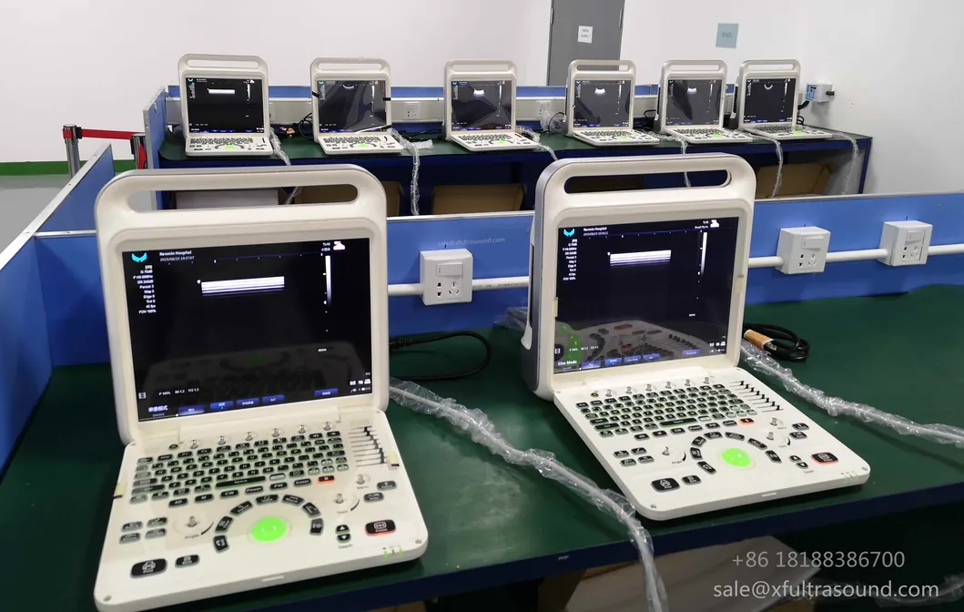 Ultrasound Machine Feature 2