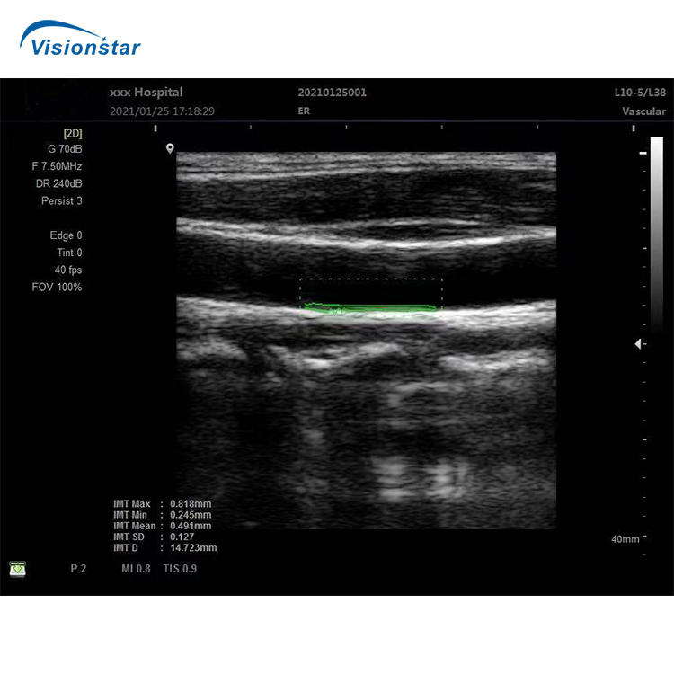 Medical Diagnosis Equipment Portable Professional Ultrasound Diagnostic Equipment with Ob Gyn