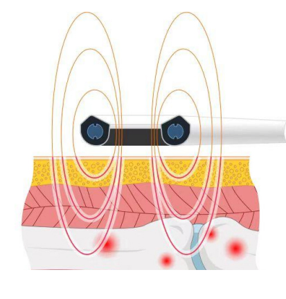 Pulsed Magnetic Therapy Magnet Cervical Magnetic-Therapy-Device Foshan Pemf Controller Physical Rehabilitation
