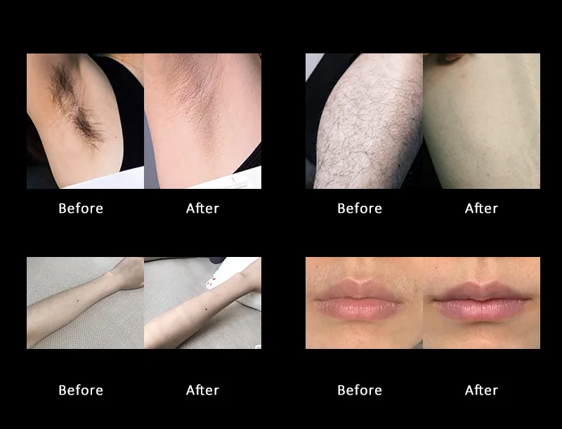 Treatment Effectiveness