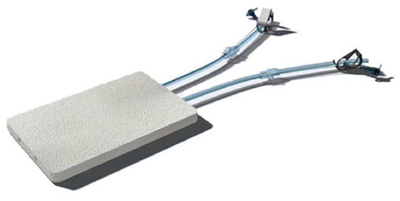 Wound Care Treatment Npwt Disposable Vacuum Sealing Drainage Dressing Kit Orthopedic Product