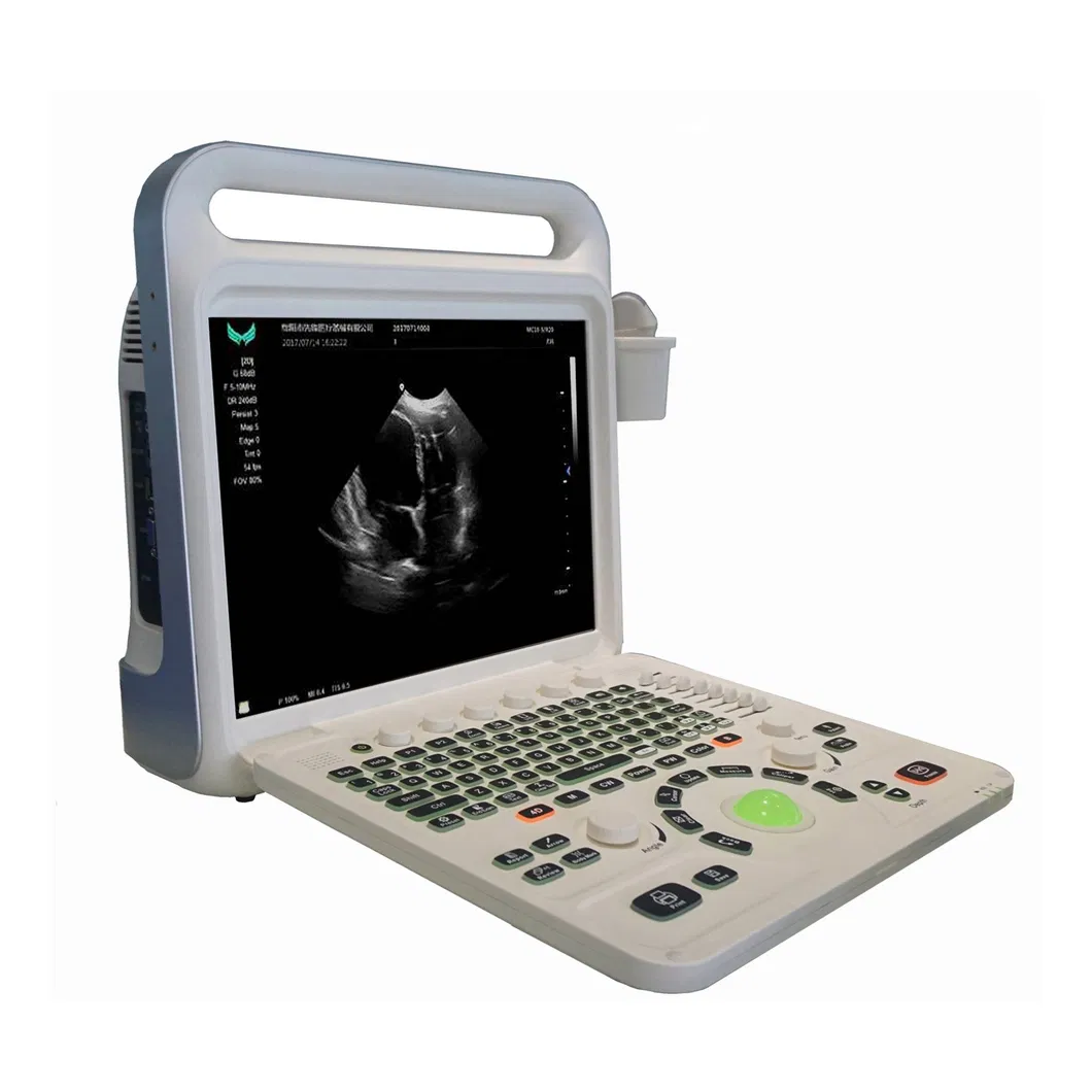 Ultrasound Machine Main View