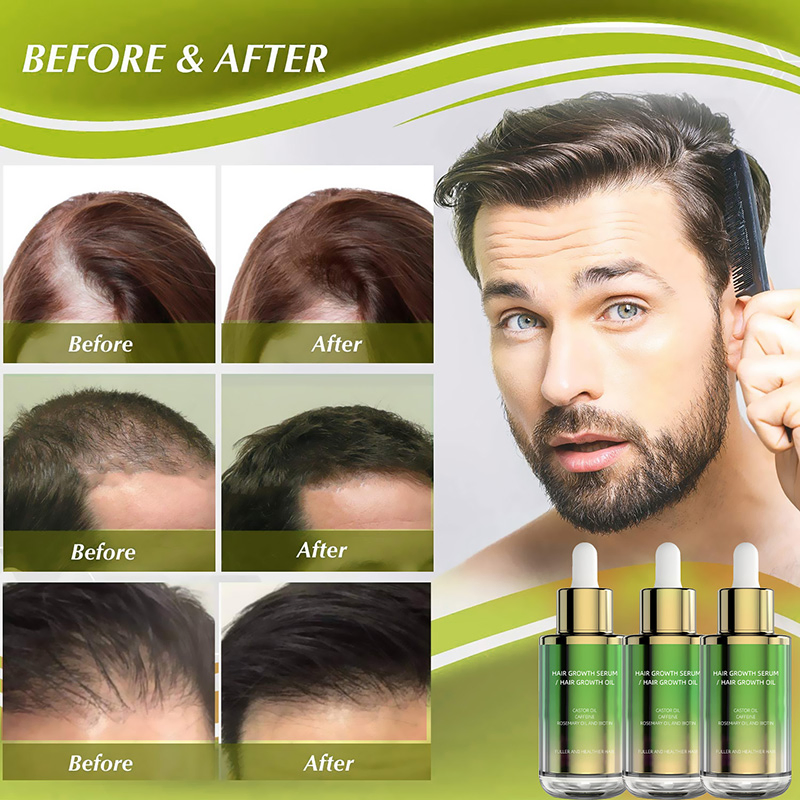 Natural Private OEM/ODM 100% Natural Organic Label Hair Growth Oil Serum Rosemary Mint Scalp Strengthening Organic Anti Hair Loss Hair Growth Serum