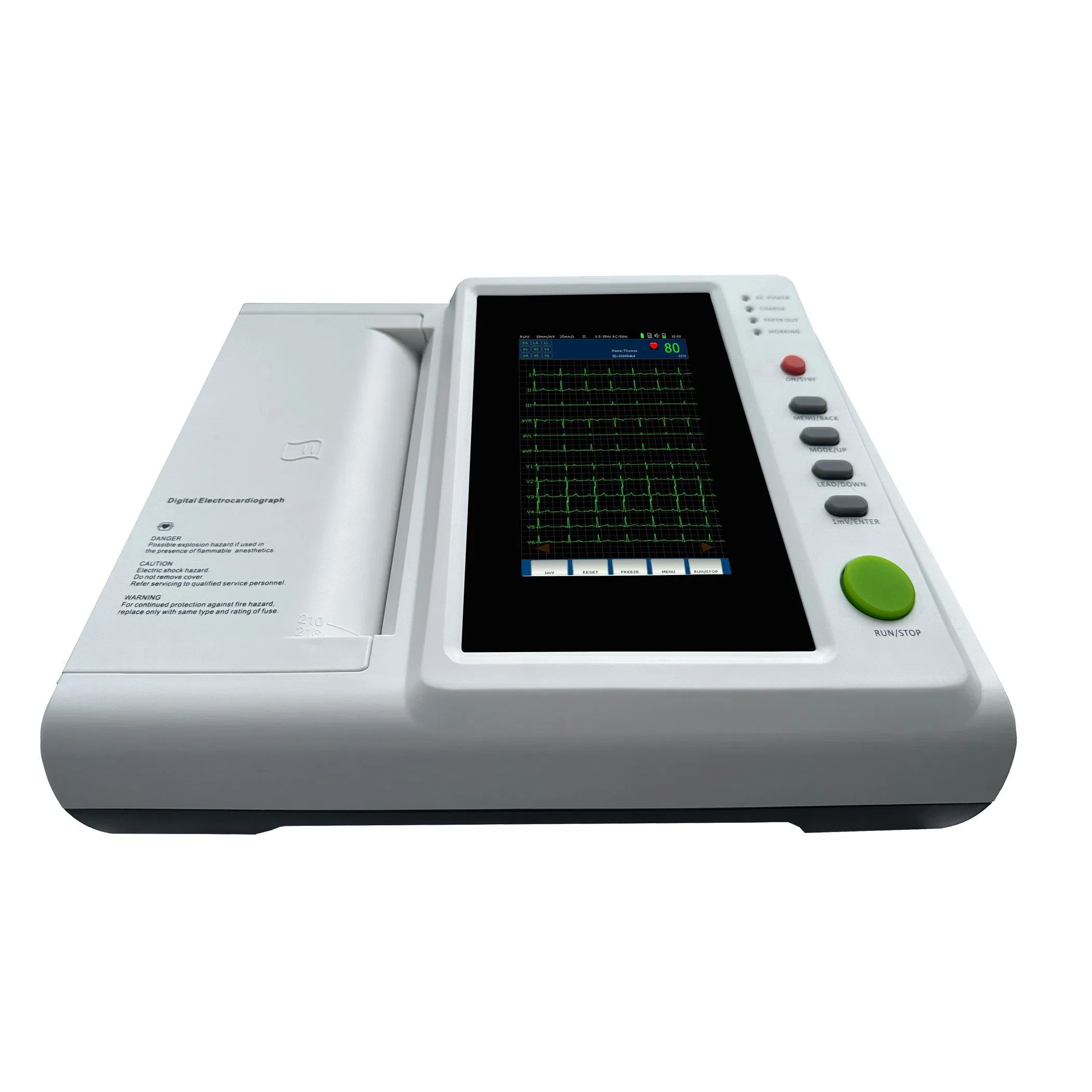 Advanced Portable ECG Device with 12-Channel Auto-Analysis