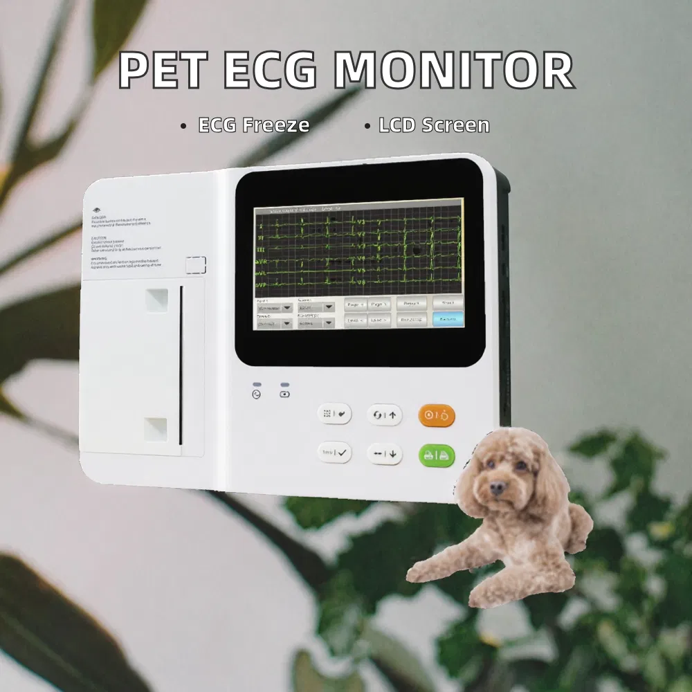 ECG Monitor Display