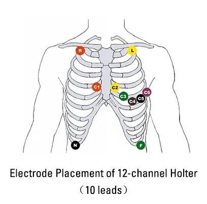 ECG Detail 2