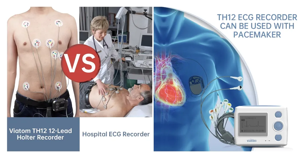 ECG Feature Display 2