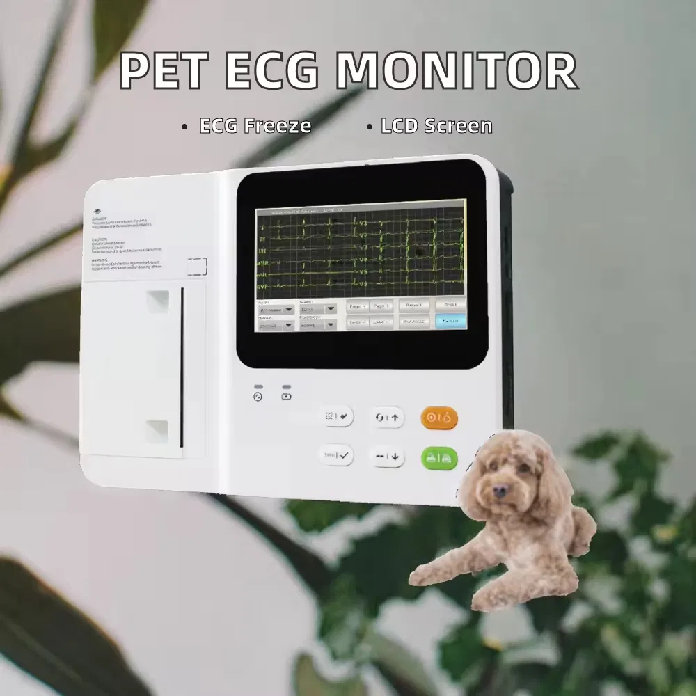 Advanced ECG Monitor with Real-Time Heart Rate Tracking and Alerts