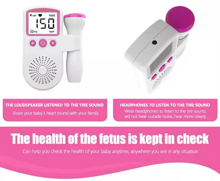 Fetal Doppler Image 5