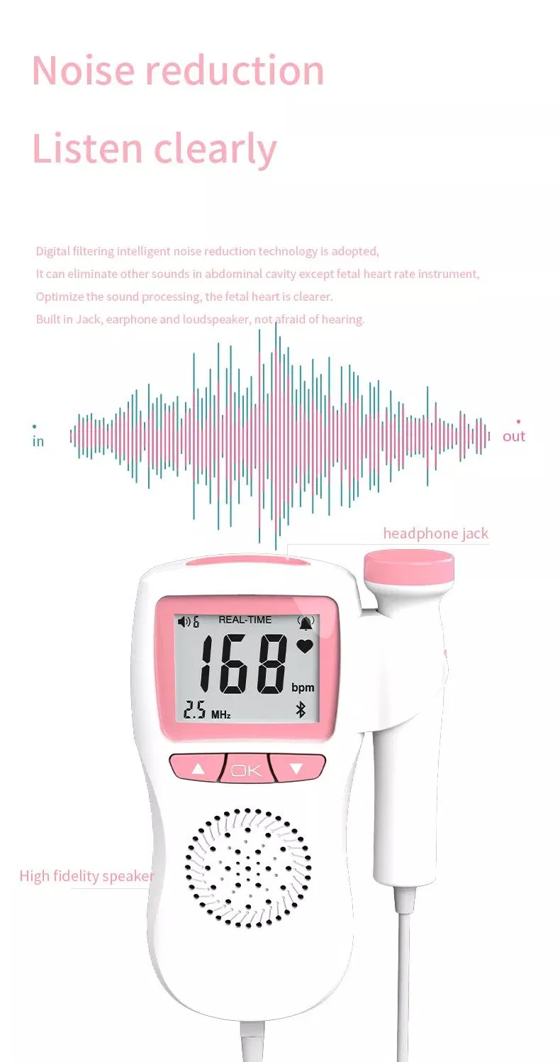Fetal Doppler Detail 3