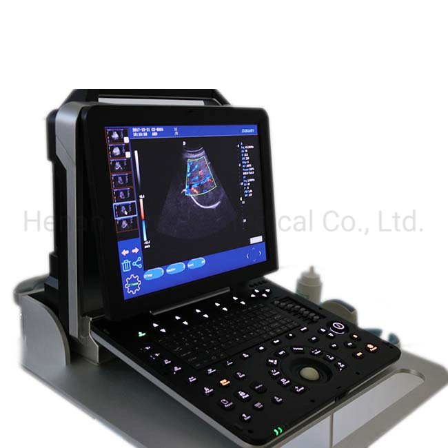 Obstetrics and Gynecology Department 4D Fetal Doppler