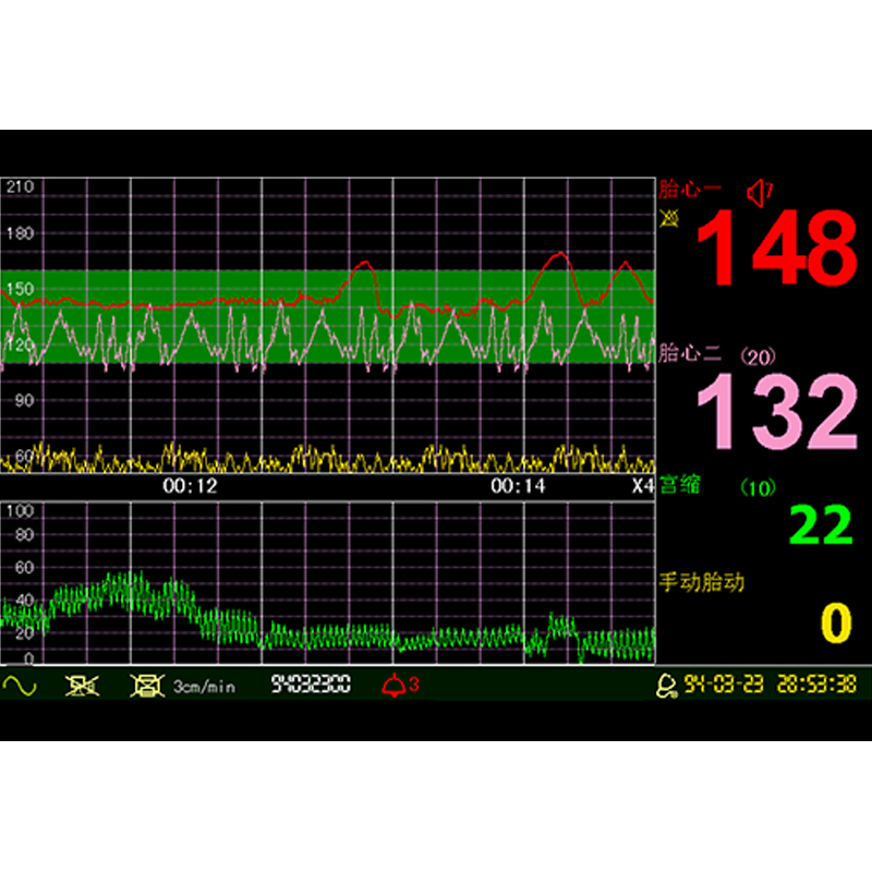 Medical Electronic Cardiotocograph Fetal Doppler Baby Heart Rate Monitor