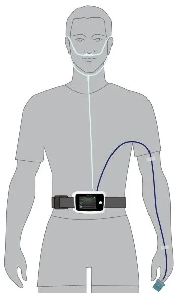 Sleep Monitoring Device Advantage