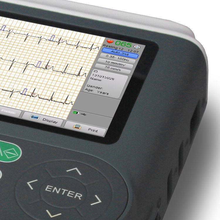 Veterinary Monitors Pet Hospital Use ECG Machine with 12 Leads Electric Power Source Electrocardiogram