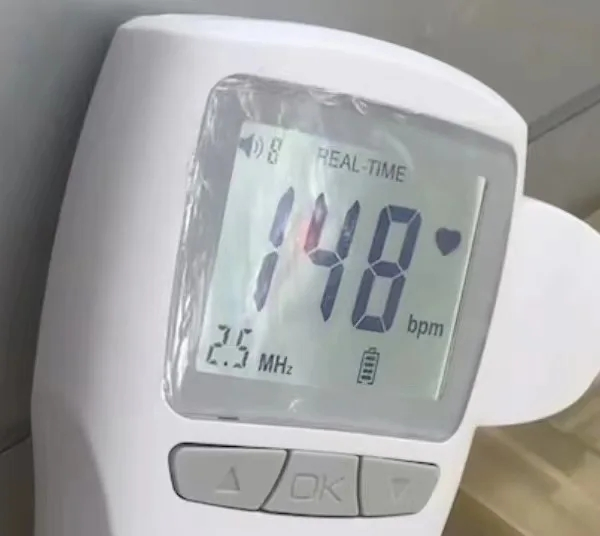 Medical Pregnant Woman Use Ultrasound Sonar Doppler Fetal Heart Rate Monitor