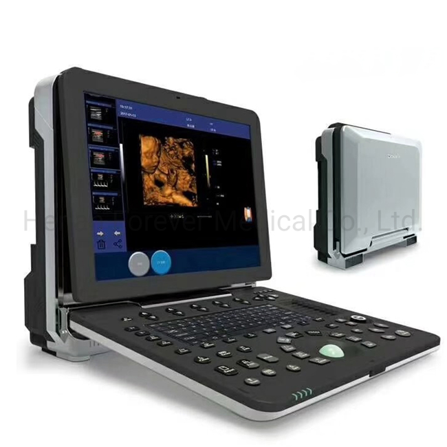 Obstetrics and Gynecology Department 4D Fetal Doppler