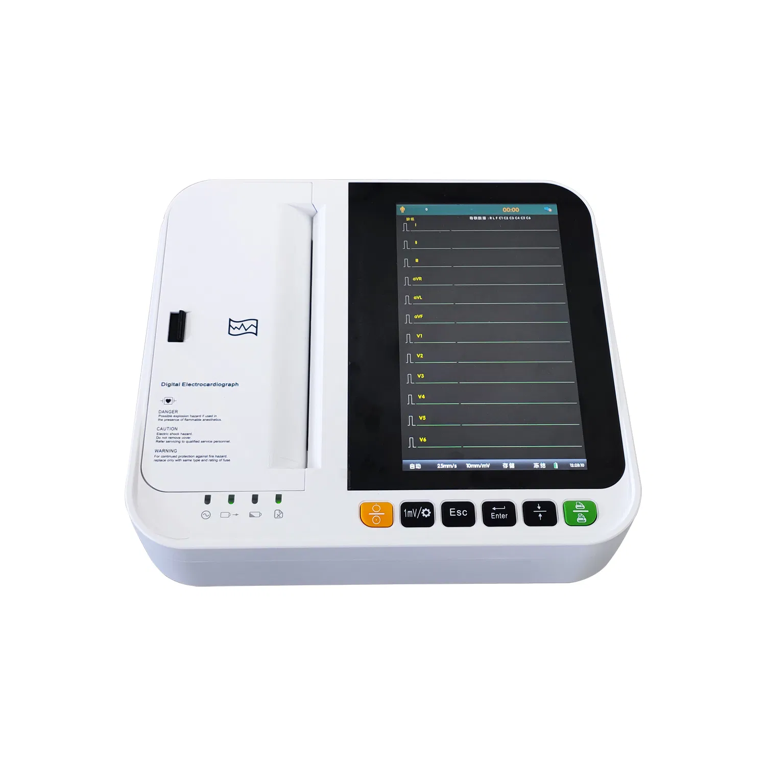 Advanced ECG Monitor with Real-Time Heart Rate Tracking and Alerts