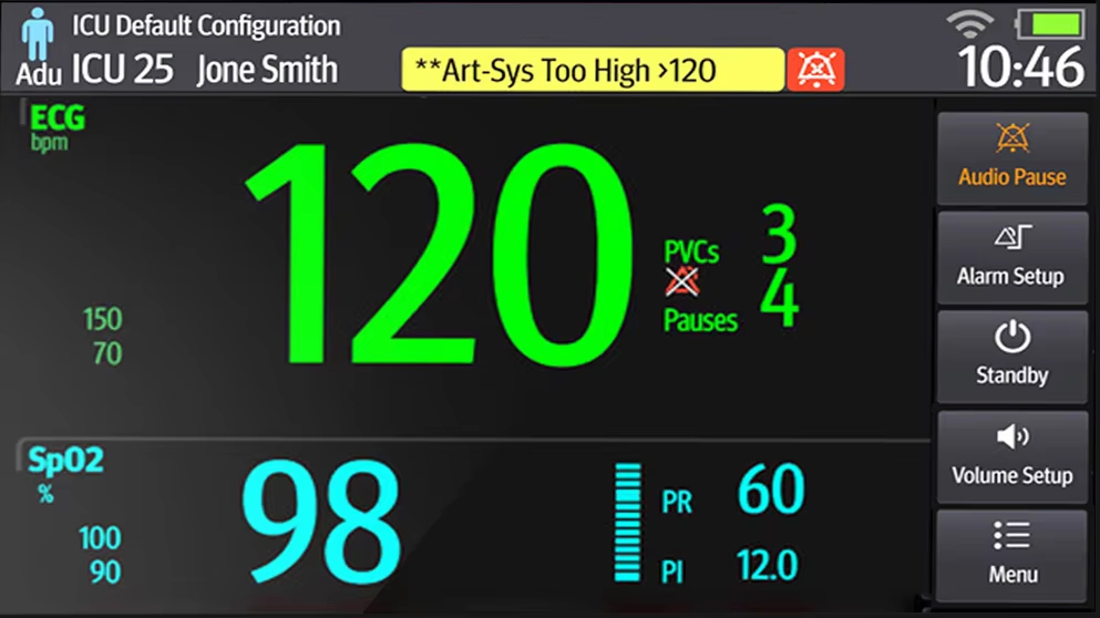 Portable Vital Sign Monitor with ECG Patient Medical Monitor Medical Equipment