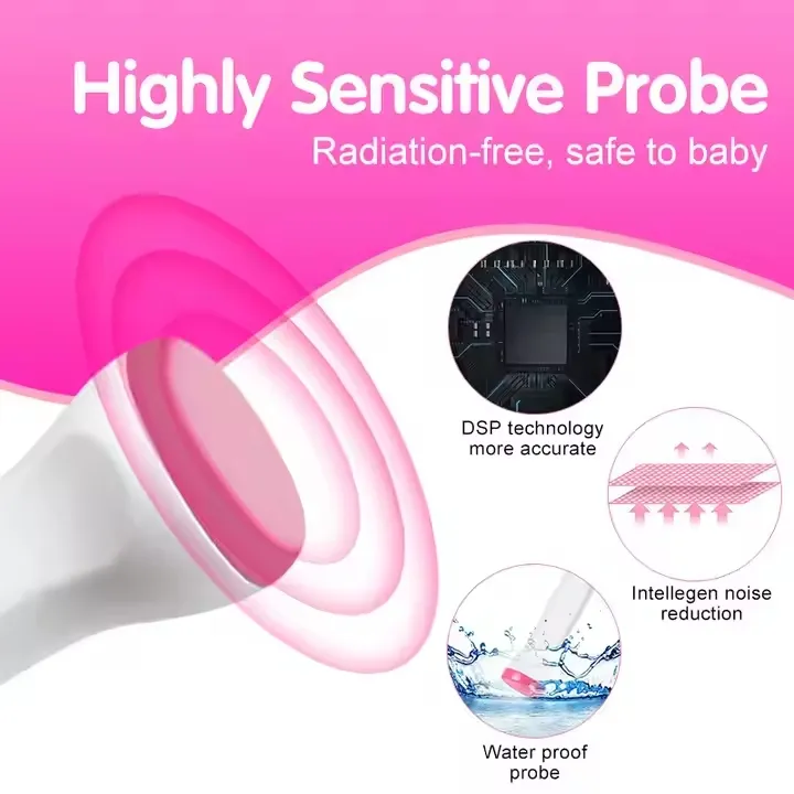 Fetal Doppler Image 2