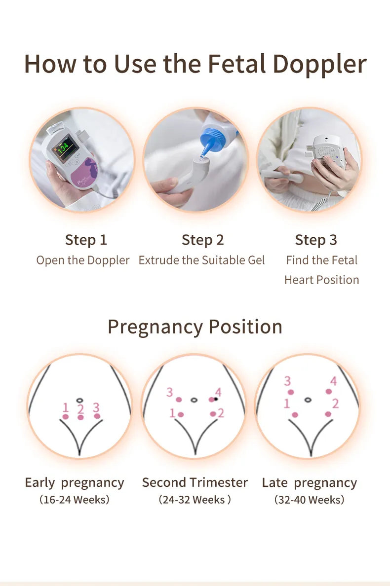 Fetal Doppler Details