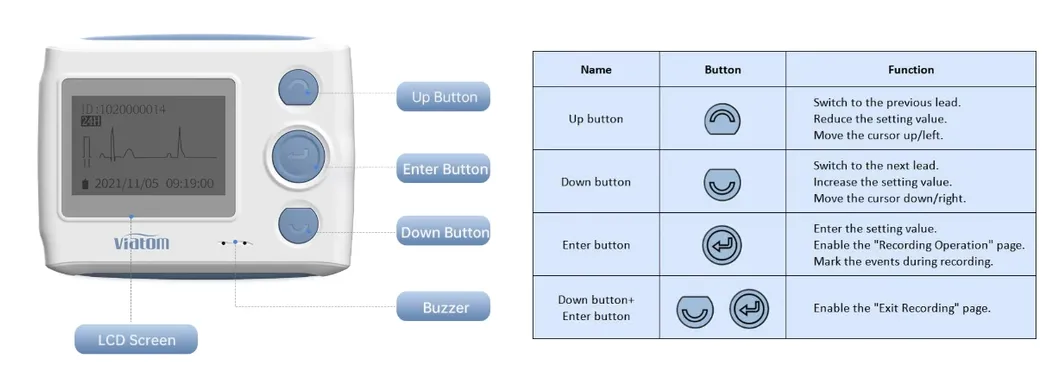 ECG Feature Display 1