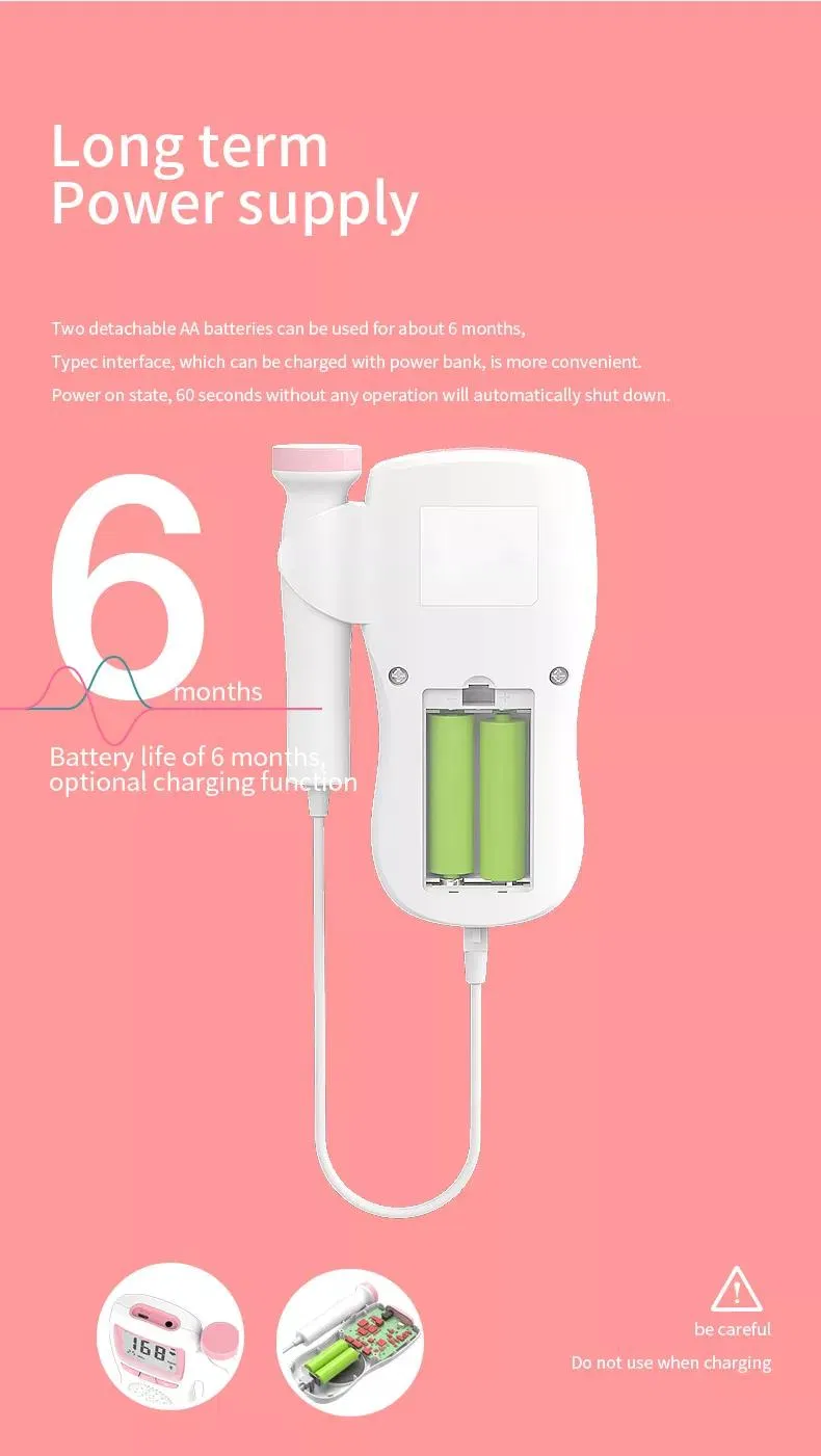 Fetal Doppler Detail 6