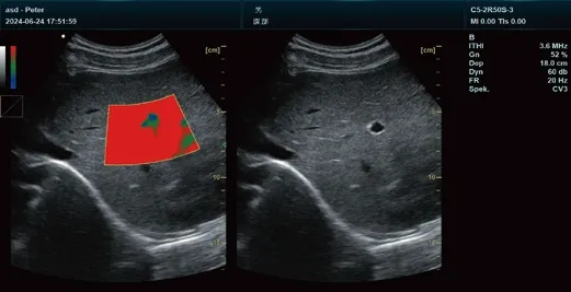 Ultrasound Display Screen