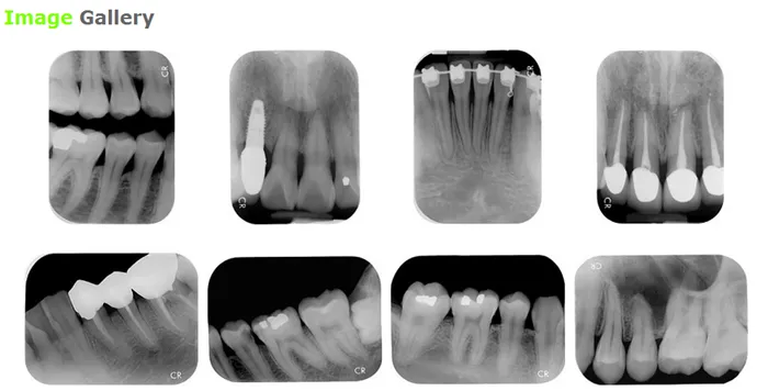 Digital Intraoral Radiography 3