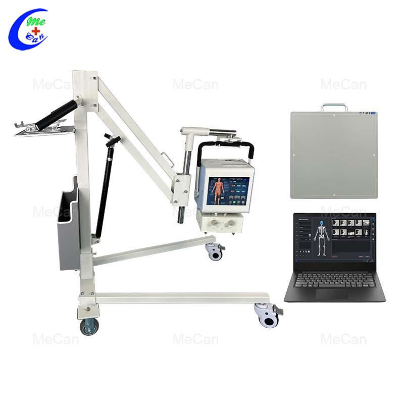 Low Price Digital 5kw 100mA Hospital Xray Radiology Equipment