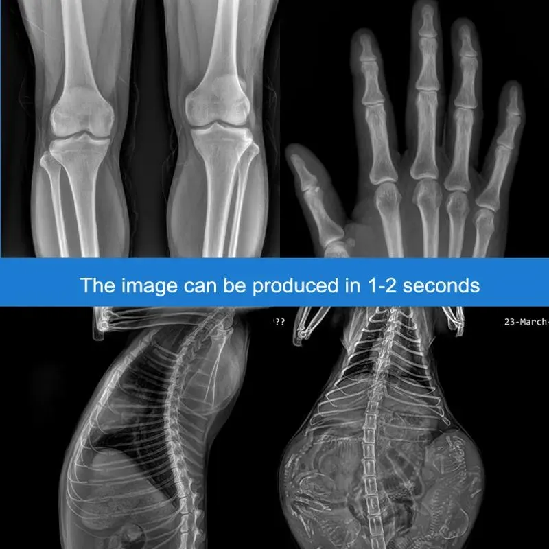 X-ray Detector Image 2