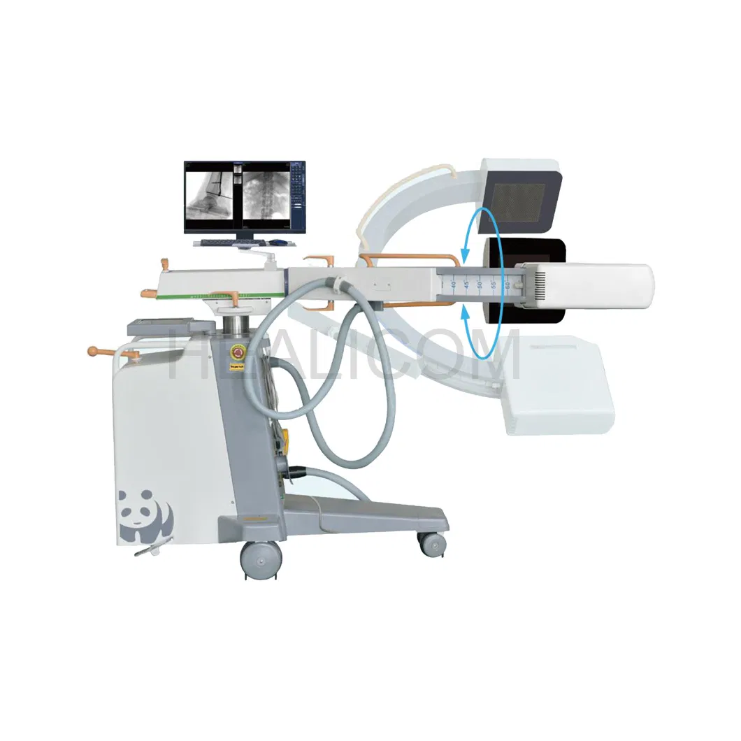 Medical 5kw Digital Hf Mobile Digital C-Arm System with Dynamic Flat-Panel Detector
