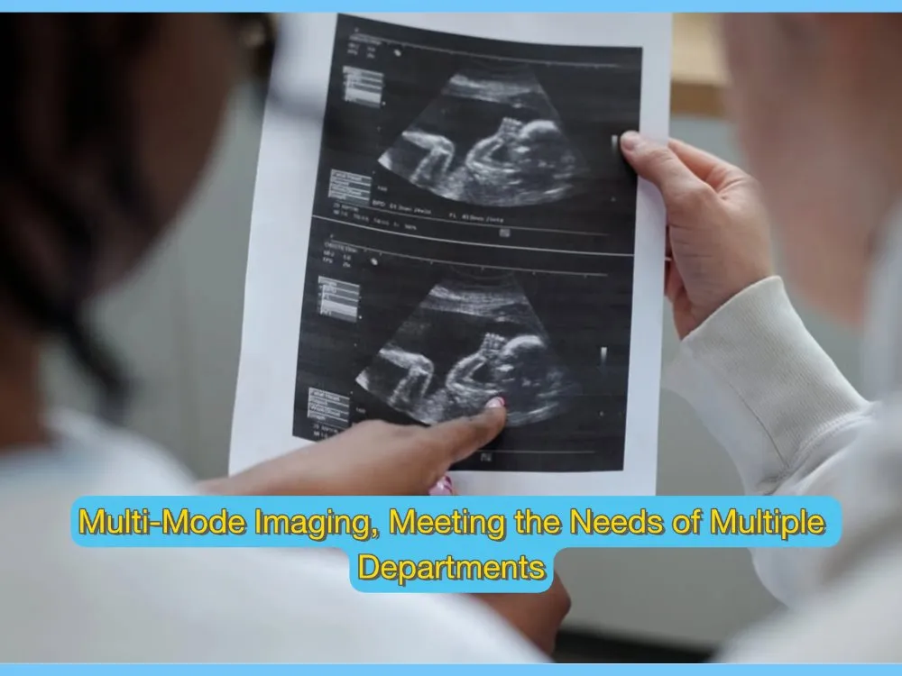 U20 Ultrasound System Application